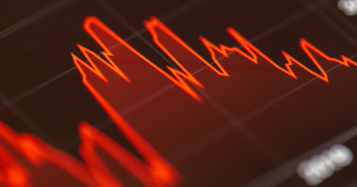 Five Key Benefits Of Endpoint Detection & Response as a Service